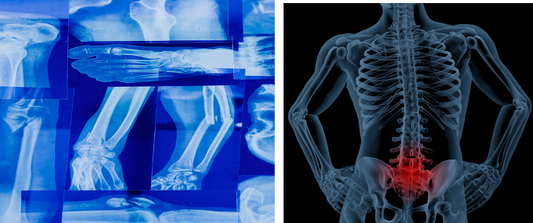 Inflammation and disorders by Joy Wisdom